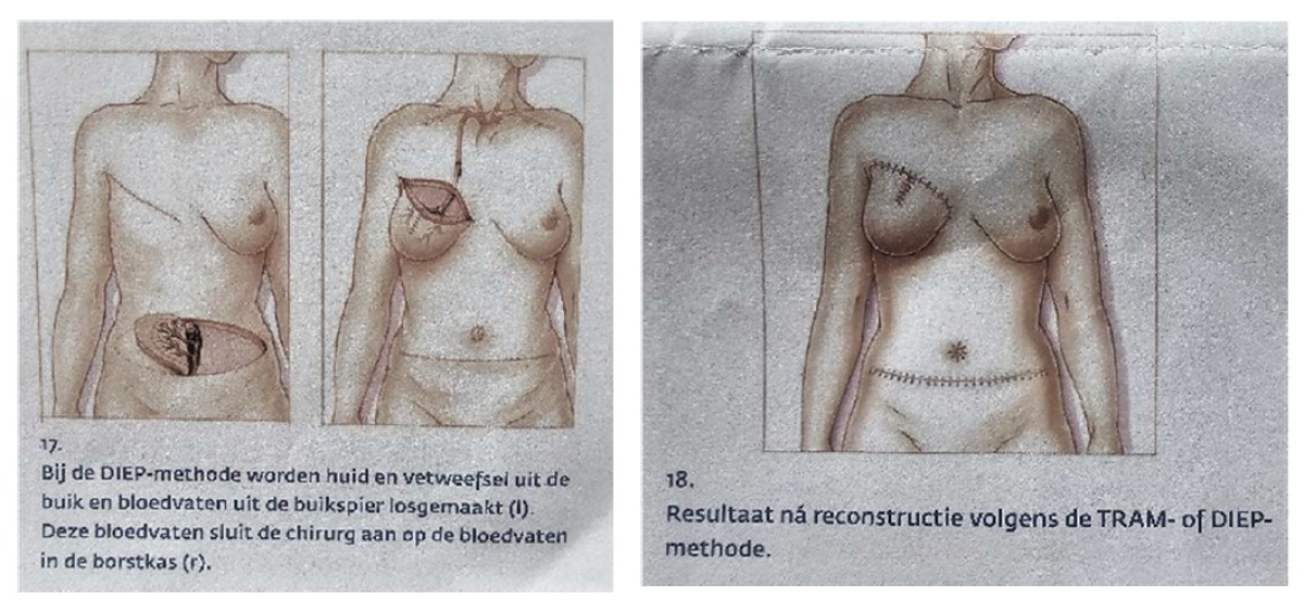 origineel 